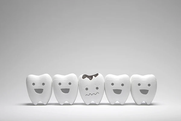 Row of five toy teeth, all smiling except for the middle tooth which frowns because of cavities