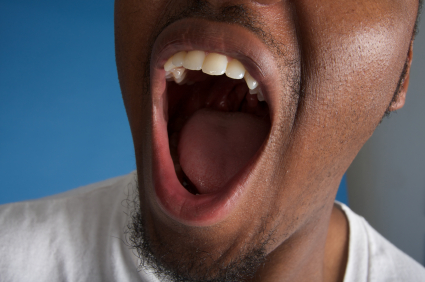 What You Need to Know About Dry Mouth